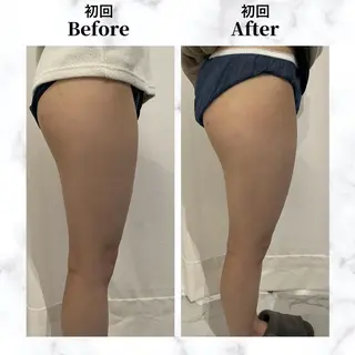 12Dハイフ💗 最強小顔のエステ・リラクイメージ