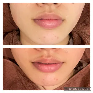 ショート カラー パーマ ヘアアレンジ メンズ キッズ ネイル マツエク・マツパ アイブロウ ニキビ特化型エステ 🍓最短で肌質改善のエステ・リラクイメージ