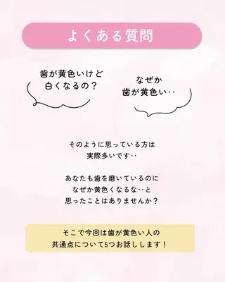 セルフホワイトニング エクシア大曽根店のその他イメージ