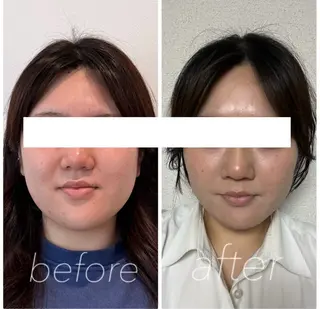 小顔と ヘッドスパのお店のエステ・リラクイメージ