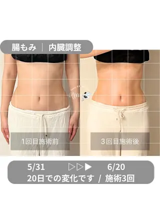 【頭痛、睡眠改善】 salon RUUのエステ・リラクイメージ