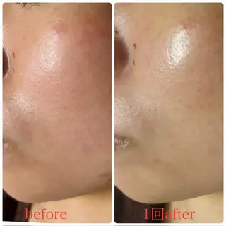 美ola ビオラのエステ・リラクイメージ