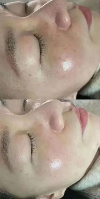 aliaハイフ&水光ジェットサロン所属・aliaハーブ水光店 エステティシャン募集のエステ・リラクイメージ