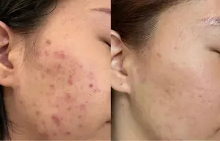 マツエク・マツパ 愛維美水光美肌専門店所属・愛維美水光美肌専門店 メンズレディースokのエステ・リラクイメージ