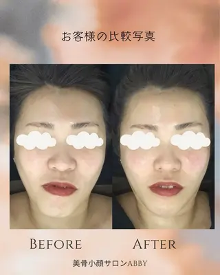 小顔コルギ💎 ABBY SANOのエステ・リラクイメージ