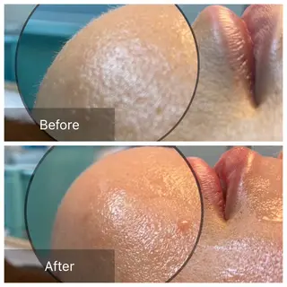 石井 千恵の眉毛・アイブロウイメージ