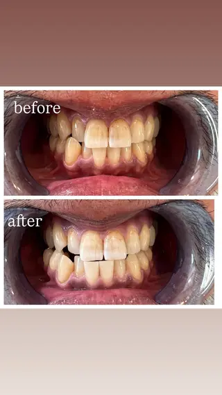 セルフホワイトニング Shineeのエステ・リラクイメージ