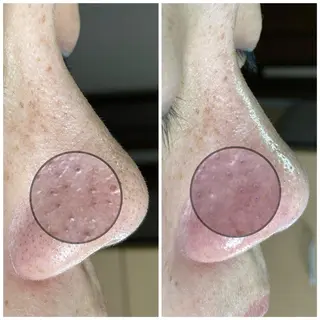 目元と毛穴の専門店　kawamura所属・かわむら ゆりのマツエク・マツパデザイン