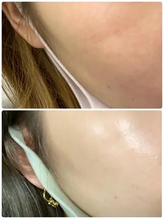 PLATINUM Beauty 横浜店所属・ホワイトニングルーム 横浜店のその他イメージ