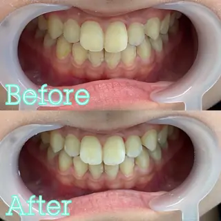 歯のホワイトニング専門店 MIGAQ 京都四条大宮店所属・佐藤 未来の眉毛・アイブロウイメージ