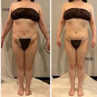 ✨痩身 ✨ハイパーナイフEXのエステ・リラクイメージ