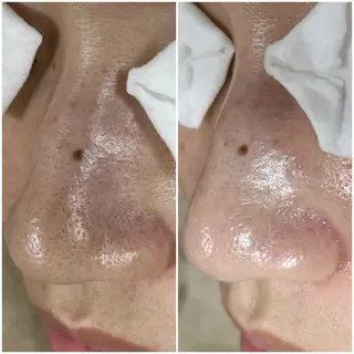 毛穴洗浄専門店/ 泉佐野/oluoluのエステ・リラクイメージ