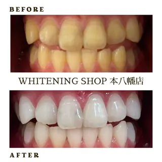 メンズ ホワイトニング ショップ本八幡店のエステ・リラクイメージ