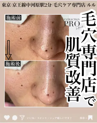 LULU所属・LULU ルルのエステ・リラクイメージ