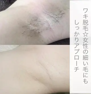 脱毛&ビューティー A'nJUDYの眉毛・アイブロウイメージ