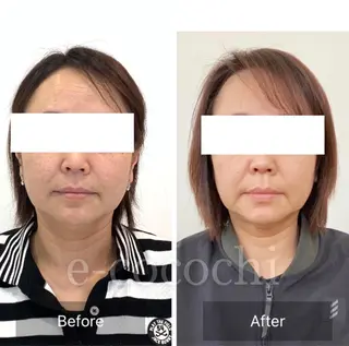 小顔と ヘッドスパのお店のエステ・リラクイメージ