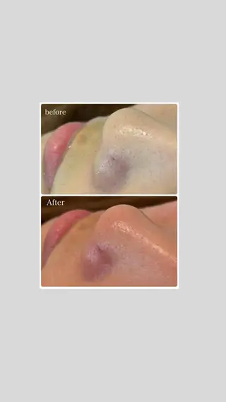 韓国肌管理 【毛穴専科】のエステ・リラクイメージ