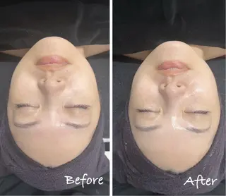 Genesis Plus大津京店のエステ・リラクイメージ