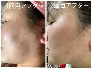 デトックス専門サロン ココシュエットのエステ・リラクイメージ