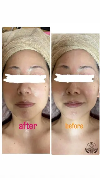 kuppy所属・lymph coconのエステ・リラクイメージ