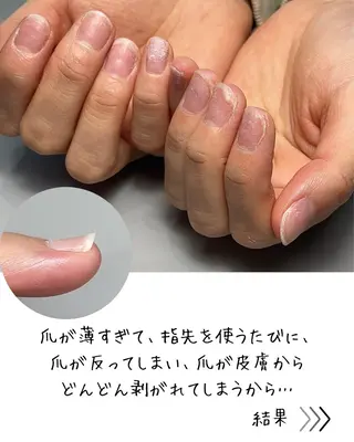 ネイル Aim* 深爪・自爪育成専門店のネイルデザイン