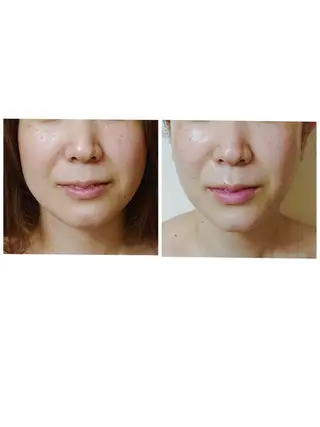 杉井 美恵のエステ・リラクイメージ