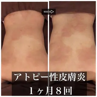 ミディアム カラー パーマ ヘアアレンジ メンズ キッズ ネイル マツエク・マツパ ニキビ・肌質改善専門 ♡人生が変わるサロンのエステ・リラクイメージ