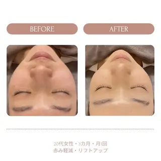 脱毛 Beauty salon Lumiere(ルミエール)所属・完全都度払い脱毛⭐︎ Lumiereのエステ・リラクイメージ