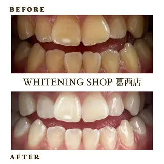 メンズ ホワイトニング ショップ葛西店のその他イメージ