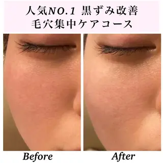 Bellesthe （ベルエステ）のエステ・リラクイメージ