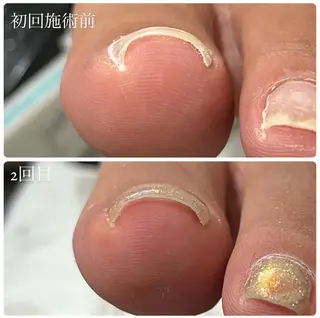 ネイル kupu所属・ネイルサロン kupuのネイルデザイン