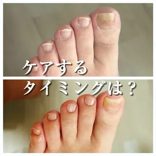 巻き爪フットケアサロンKotori所属・フットケアサロン Kotoriのその他イメージ