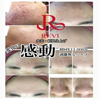 LILIANA所属・LILIANA ☆YURIのエステ・リラクイメージ