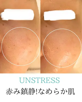 田中For..天王寺 肌質改善/よもぎ蒸しのエステ・リラクイメージ