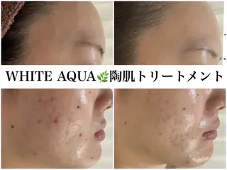 ハーブピーリング/ ララピール専門店のエステ・リラクイメージ