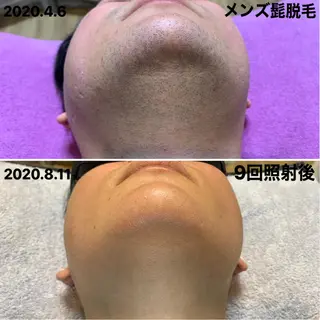 メンズ 脱毛＆エステサロン【アンリミット】所属・森谷 莉美のエステ・リラクイメージ