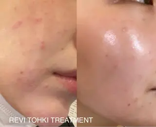 Private salonA.　伊藤のマツエク・マツパデザイン