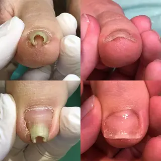 東京巻き爪アカデミー所属・東京巻き爪 アカデミーのエステ・リラクイメージ