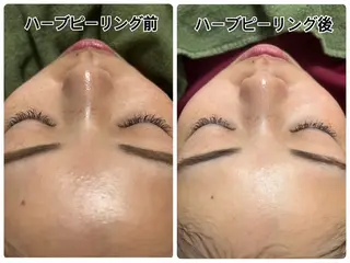 みんなの脱毛ツルリン ☀️船橋店☀️のエステ・リラクイメージ