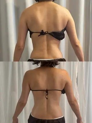 小顔|痩身salon miélu ミエルのエステ・リラクイメージ