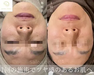 Grandir所属・ハーブピーリング専門 グランディール　武内のエステ・リラクイメージ