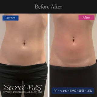 伊藤 正美のマツエク・マツパデザイン