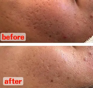 Espoir /エスポワール所属・三澤 秀基のエステ・リラクイメージ