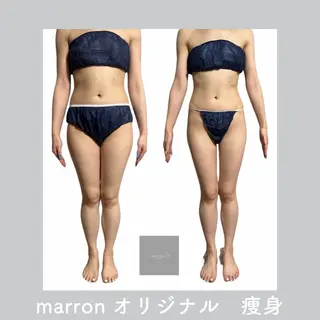 marron所属・痩身ハイパーナイフ ララピールリアボーテのエステ・リラクイメージ