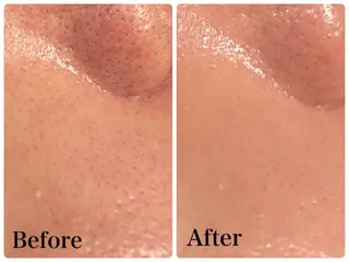 Gemini 　MIKIのエステ・リラクイメージ