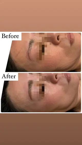 アイブロウ ハーブピーリング専門 muro.のエステ・リラクイメージ