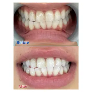 MBEAUTYSALON 千葉店・京成大久保所属・Melty 輝のその他イメージ