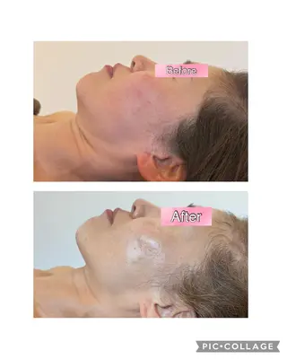 🅖🅤🅩🅔🅛 salonのエステ・リラクイメージ