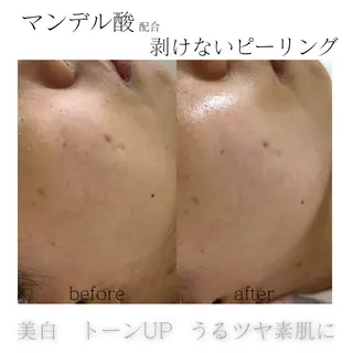 メンズ 歌舞伎町深夜サロン to mëのエステ・リラクイメージ