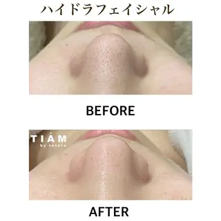 美肌サロンTIAM by tetoteのエステ・リラクイメージ